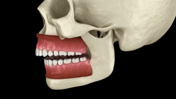 Overbite oclusão dentária (má oclusão dos dentes). Animação 3D de dente medicamente precisa — Vídeo de Stock