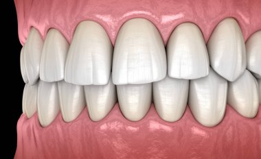 Normal tıkantılı sağlıklı insan dişleri, yan görünüm. Tıbbi olarak doğru diş 3d illüstrasyon