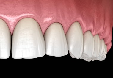 Büyük insan sakızı ve dişleri. Tıbbi olarak doğru diş 3D illüstrasyon
