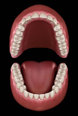 Diş anatomisi - Açık Protezler. Tıbbi olarak doğru diş 3d illüstrasyon