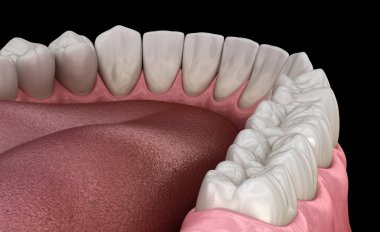 İnsan çikleti ve dişleri. Tıbbi olarak doğru diş 3D illüstrasyon