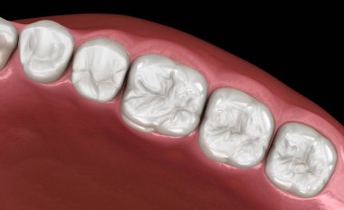 Büyük insan sakızı ve dişleri. Tıbbi olarak doğru diş 3D illüstrasyon