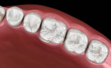 Maxillary human gum and teeth. Medically accurate tooth 3D illustration clipart