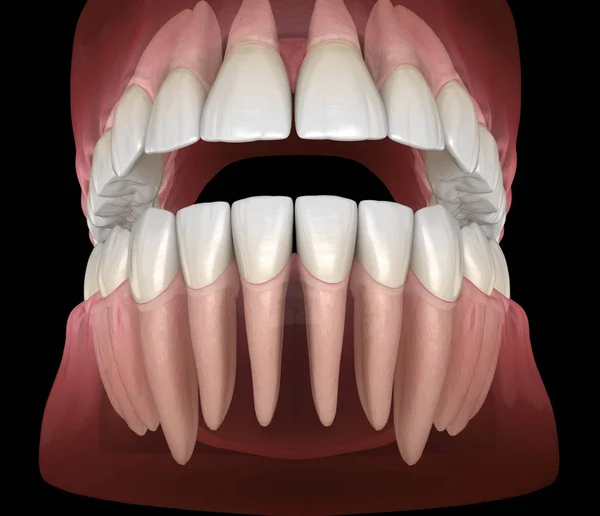 Морфология Челюстной Челюстной Десен Зубов Человека Медицинская Точность Трехмерной Иллюстрации — стоковое фото
