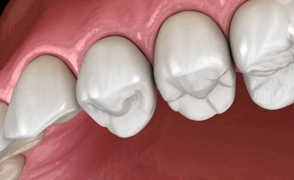 上颌人类的牙龈和牙齿 医学上准确的牙齿3D图像 — 图库照片