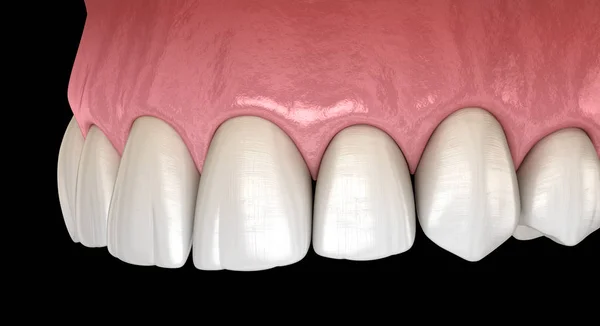 Maxillair Menselijk Tandvlees Tanden Medisch Nauwkeurige Tand Illustratie — Stockfoto