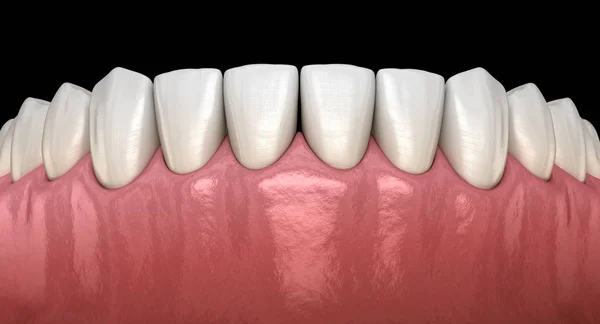 Nsan Çikleti Dişleri Tıbbi Olarak Doğru Diş Illüstrasyon — Stok fotoğraf