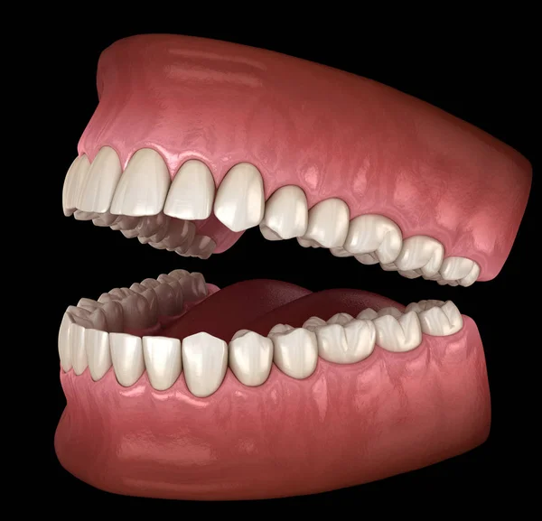 Anatomia Dentária Dentaduras Abertas Ilustração Odontológica Medicamente Precisa — Fotografia de Stock