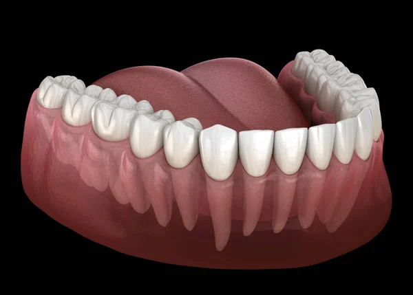 Morphology of mandibular human gum and teeth. Medically accurate tooth 3D illustration