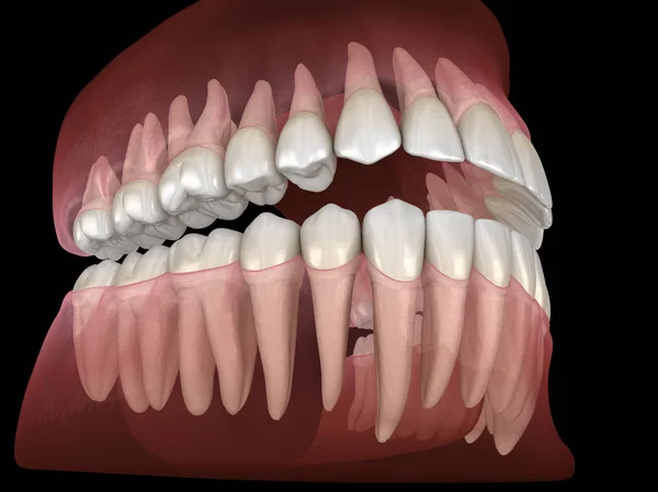 Morphologie Von Unterkiefer Und Oberkiefer Menschliches Zahnfleisch Und Zähne Medizinisch — Stockfoto