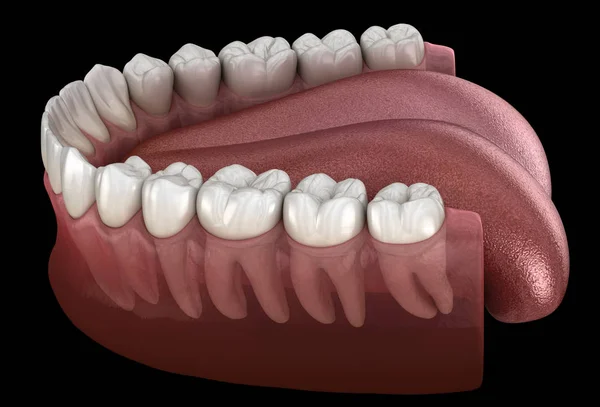 Goma Dientes Humanos Mandibulares Ilustración Dientes Médicamente Precisos —  Fotos de Stock