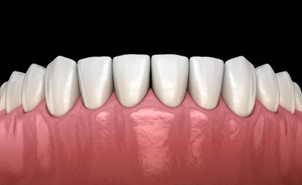Gomme Denti Umani Mandibolari Illustrazione Del Dente Clinicamente Accurata — Foto Stock