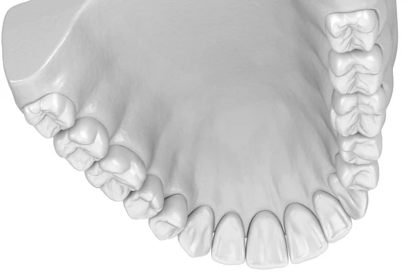Maksiller Insan Diş Eti Beyaz Tarzda Dişler Tıbbi Olarak Doğru — Stok fotoğraf