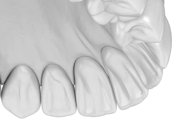 Gomma Umana Maxillary Denti Stile Bianco Illustrazione Del Dente Clinicamente — Foto Stock