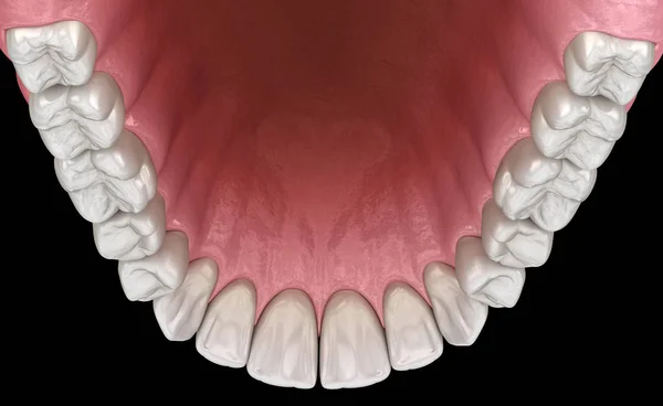 Maxillary Human Gum Teeth Medically Accurate Tooth Illustration — Stock Photo, Image