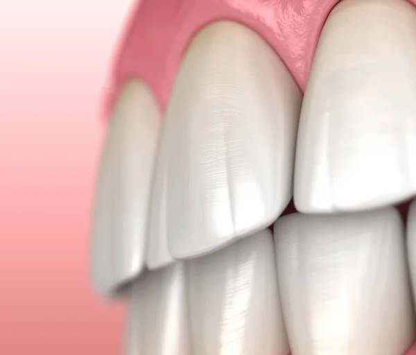Friska Mänskliga Tänder Med Normal Ocklusion Makrovy Medicinskt Exakt Tand — Stockfoto