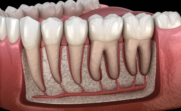 잇몸과 치아의 해부학 엑스레이 의학적으로 정확한 일러스트레이션 — 스톡 사진