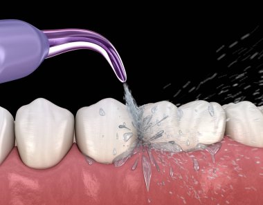Tahriş edici, su dişleri temizliği. Ağız hijyeni tıbbi olarak doğru 3d illüstrasyon.