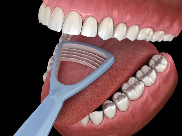 舌洗浄 スクレーパー 口腔衛生の医学的に正確な3Dイラスト — ストック写真