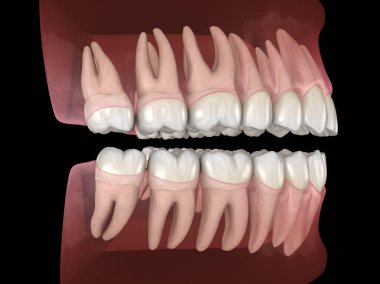 Mandibular ve maksiller insan diş eti ve dişlerin morfolojisi. Tıbbi olarak doğru diş 3d illüstrasyon