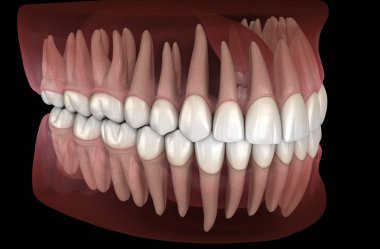 Mandibular ve maksiller insan diş eti ve dişlerin morfolojisi. Tıbbi olarak doğru diş 3d illüstrasyon