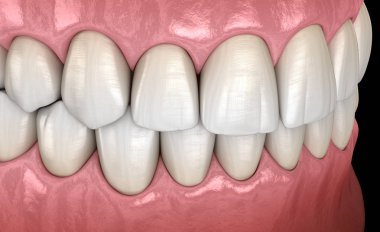 Normal tıkantılı sağlıklı insan dişleri, yan görünüm. Tıbbi olarak doğru diş 3d illüstrasyon