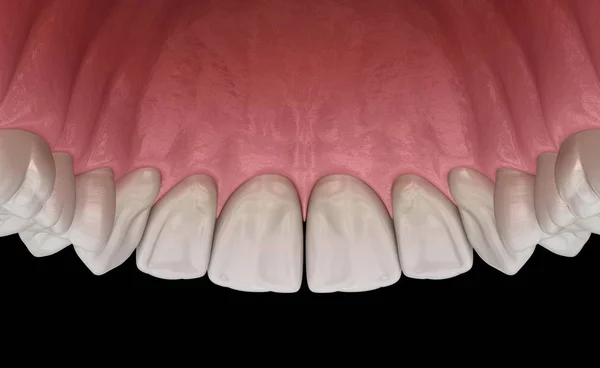 Максимальна Людська Гумка Зуби Медично Точна Ілюстрація Зуба — стокове фото