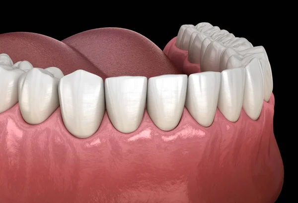 Σφαιρική Ανθρώπινη Τσίχλα Και Δόντια Ιατρικά Ακριβές Δόντι Εικονογράφηση — Φωτογραφία Αρχείου