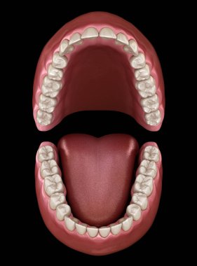 Diş anatomisi - Açık Protezler. Tıbbi olarak doğru diş 3d illüstrasyon