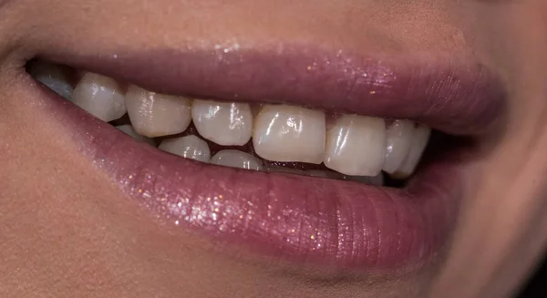 Doğal Dişleri Ile Kadın Gülümseme — Stok fotoğraf