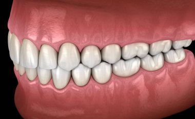 Normal tıkantılı sağlıklı insan dişleri, yan görünüm. Tıbbi olarak doğru diş 3d illüstrasyon