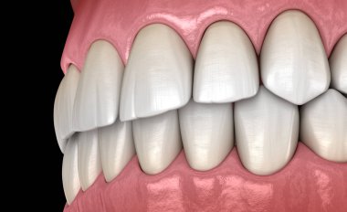 Normal tıkantılı sağlıklı insan dişleri, yan görünüm. Tıbbi olarak doğru diş 3d illüstrasyon