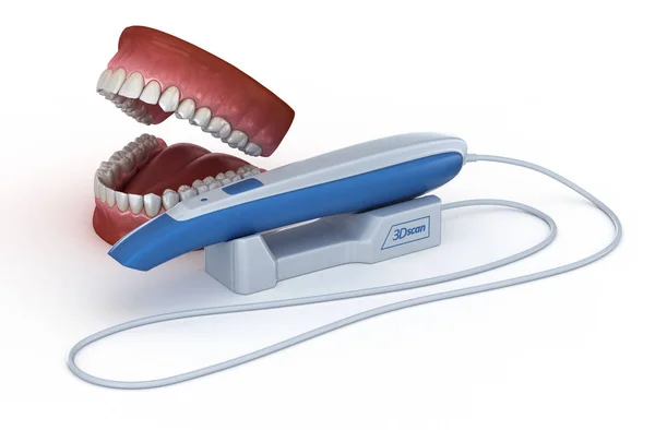 Dişler Arası Tarayıcı Kendi Tasarımım Illüstrasyon Kavramı — Stok fotoğraf