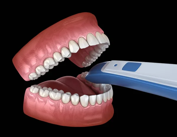 Escáner Dientes Intraorales Propio Diseño Concepto Ilustración — Foto de Stock