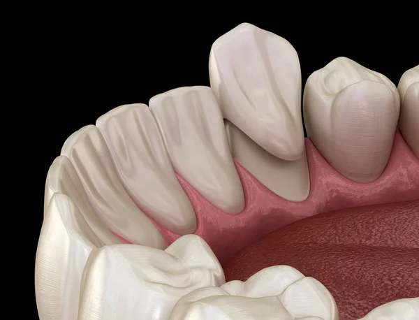 치아의 위치를 의학적으로 — 스톡 사진