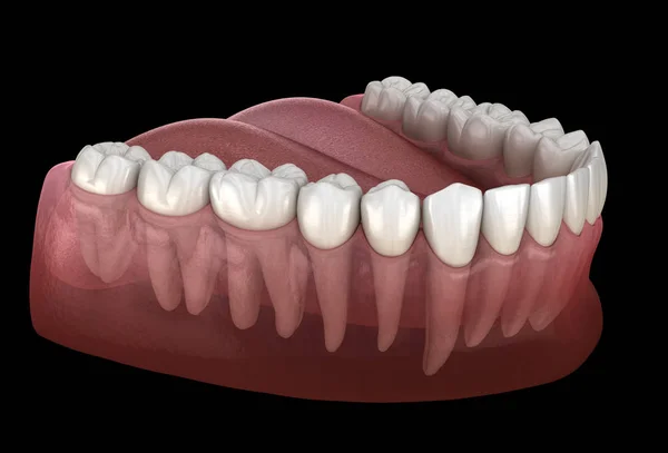 Gomme Dents Humaines Mandibulaires Illustration Dentaire Médicalement Précise — Photo