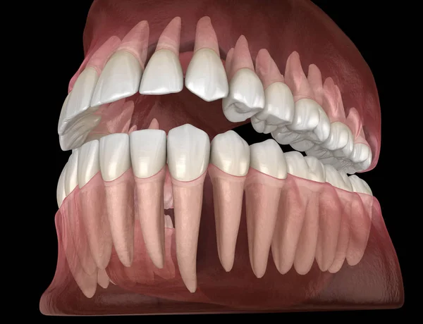 顎および上顎のヒトガムおよび歯の形態 医学的に正確な歯3Dイラスト — ストック写真