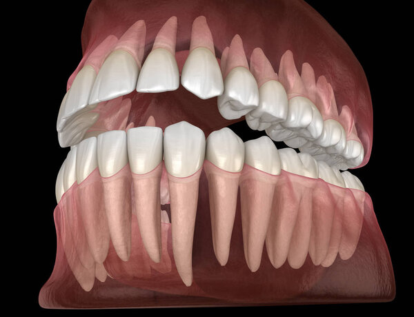 Morphology of mandibular and maxillary human gum and teeth. Medically accurate tooth 3D illustration