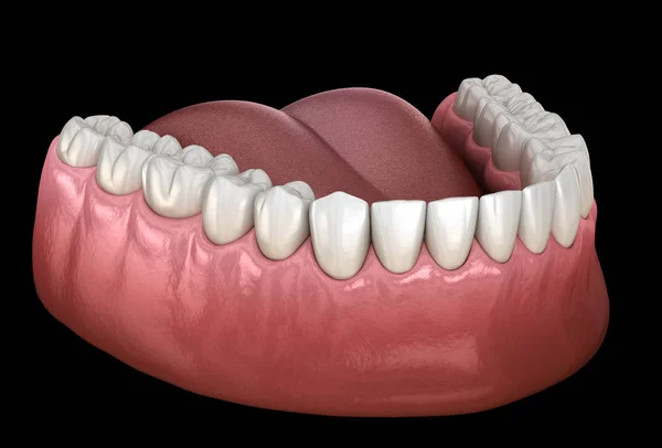 下颌骨人类的牙龈和牙齿 医学上准确的牙齿3D图像 — 图库照片