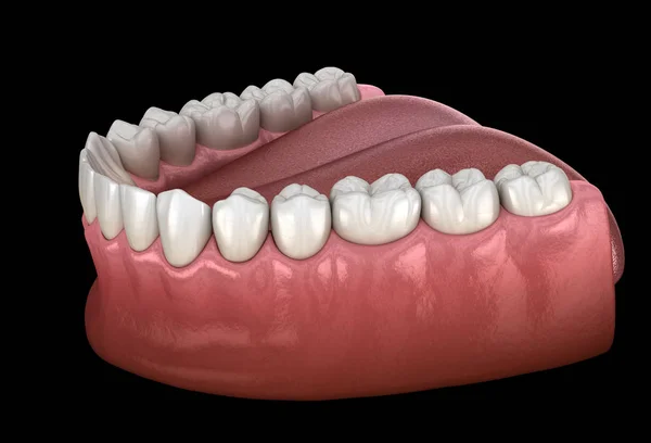 Mandibular human gum and teeth. Medically accurate tooth 3D illustration