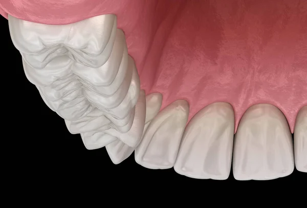 Maxilární Lidská Žvýkačka Zuby Lékařsky Přesná Zubní Ilustrace — Stock fotografie