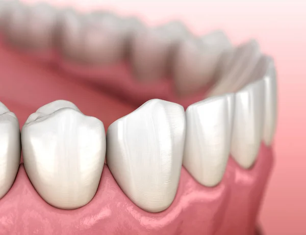 Żuchwy Ludzkiej Gumy Anatomii Zębów Medycznie Dokładna Ilustracja Zębów — Zdjęcie stockowe