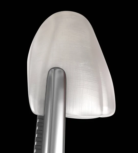 正中门牙用的口器 3D插图 — 图库照片