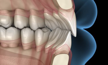 Normal tıkanma ile sağlıklı insan dişleri, 3 boyutlu illüstrasyon