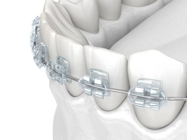 Dişler ve temiz diş telleri. Tıbbi olarak doğru olan 3 boyutlu diş illüstrasyonu