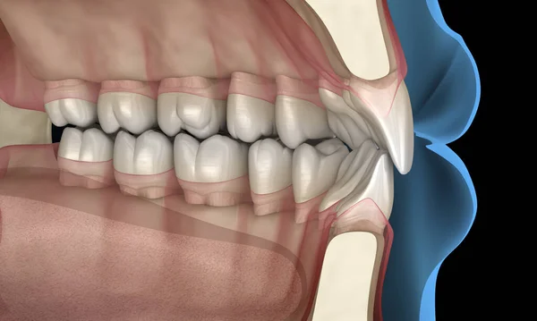 Dentes Humanos Saudáveis Com Oclusão Normal Ilustração — Fotografia de Stock