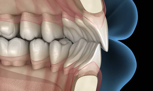 正常な閉塞を持つ健康な人間の歯 3Dイラスト — ストック写真
