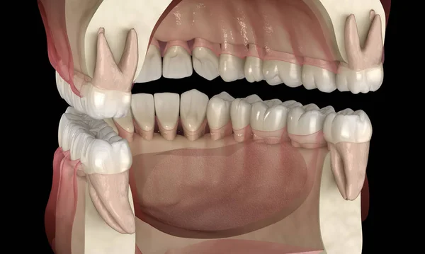 Healthy Human Teeth Normal Occlusion Illustration — Stock Photo, Image