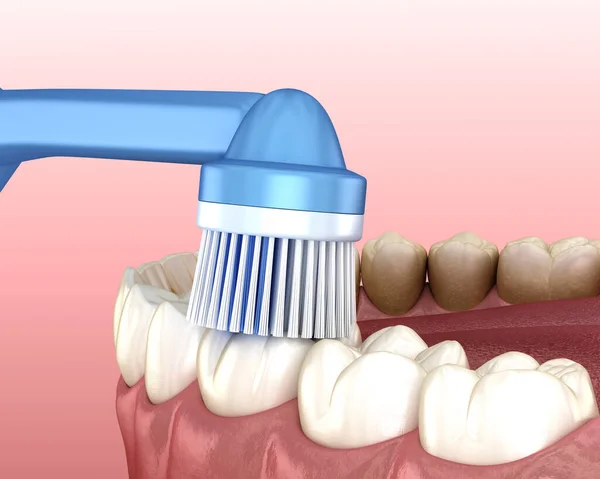 Elektrikli Diş Fırçası Beyaz Diş Fırçası Ağız Hijyeninin Tıbbi Açıdan — Stok fotoğraf