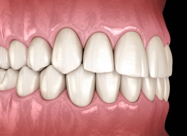 Normal tıkanıklığı olan sağlıklı insan dişleri. Tıbbi olarak doğru diş 3D illüstrasyon